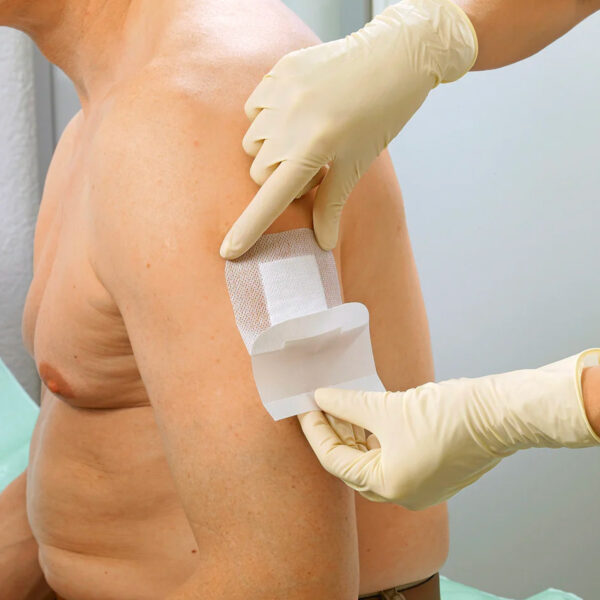 Zdjęcie prezentujące aplikację opatrunku Cosmopor E na ranie pacjenta.